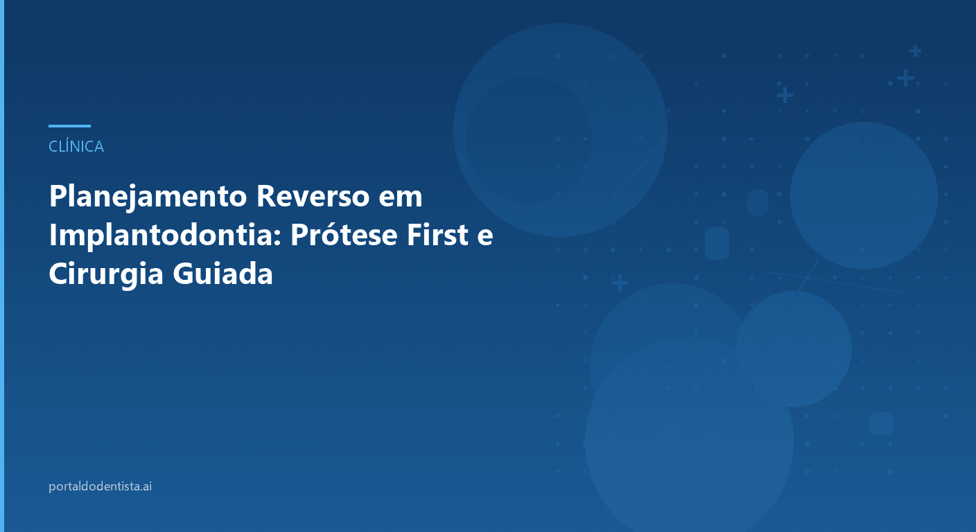 Planejamento Reverso em Implantodontia: Prótese First e Cirurgia Guiada