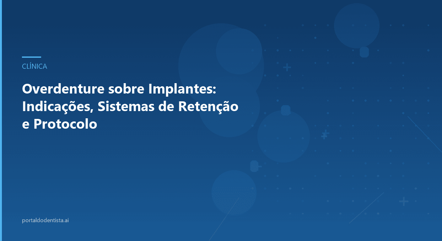 Overdenture sobre Implantes: Indicações, Sistemas de Retenção e Protocolo